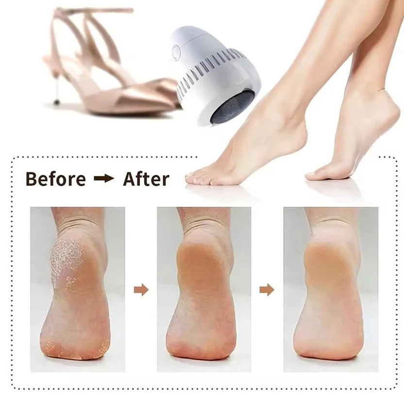 Electric Foot Callus Remover unique Dead Skin Grinder