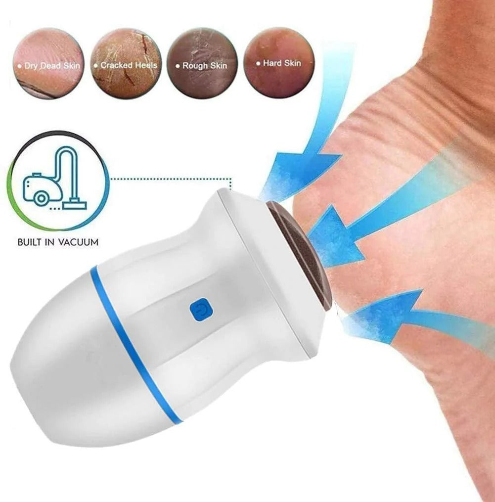 Electric Foot Callus Remover unique Dead Skin Grinder